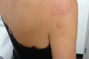 stipance plostica vedla seba